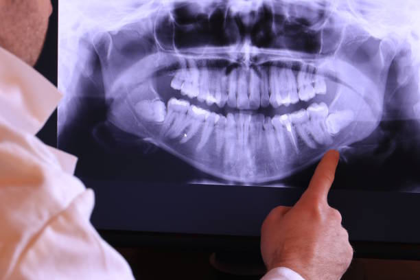 Best Emergency Dental Filling Replacement  in Lockland, OH